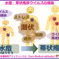 水痘・帯状疱疹ウイルスの感染